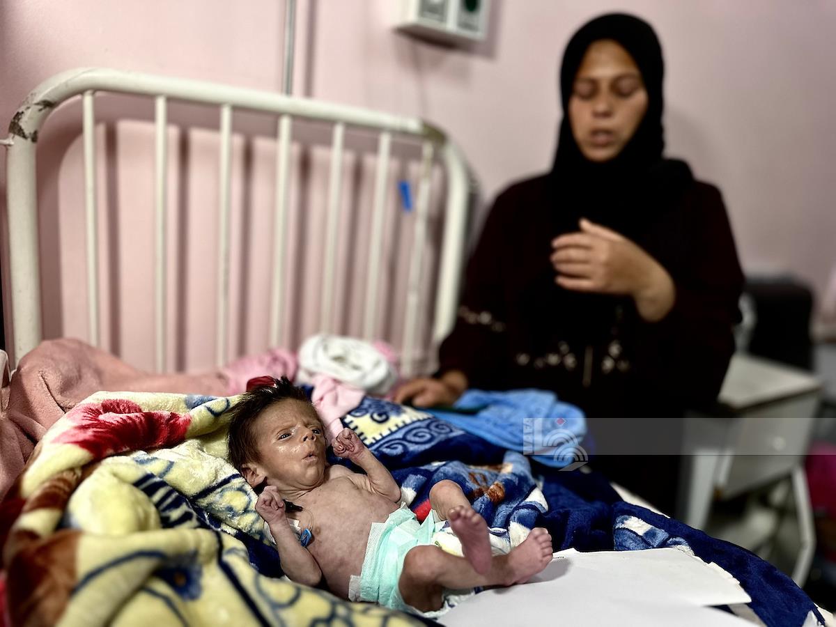 أطفال يتلقون الرعاية الصحية بسبب سوء التغذية ونقص الدواء في مستشفى ناصر الطبي بمدينة خان يونس جنوب قطاع غزة